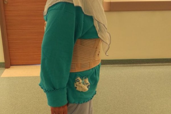 Lumbar Fractures